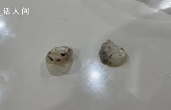 异物是鸭眼巩膜?记者解剖多个鸭头