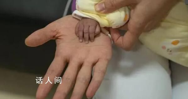 出生时仅650克的巴掌女婴出院了 终于和妈妈一起回到了家里
