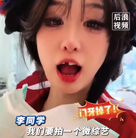 大三女生为拍作业穿古装跳舞，刚咬住扇子，大门牙直接被硌断