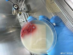 终于了解夫妻吃了竹鼠后双双确诊肺炎 拒食野味是预防关键