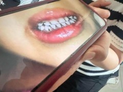 终于了解血铅异常幼儿园老师发声 违规添加剂致幼儿中毒