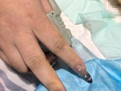 女子心跳骤停 美甲阻碍医生抢救 紧急卸甲挽救生命（图）