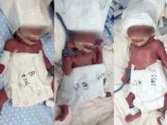 24岁女子成功诞下5胞胎 究竟咋梗?
