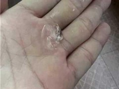 广州市中心下冰雹 强对流天气来袭（图）